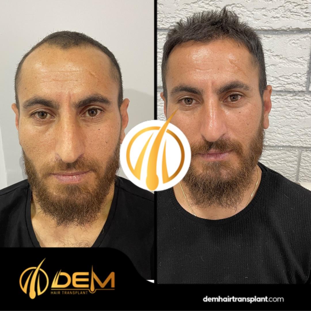 DEM sonuç 9