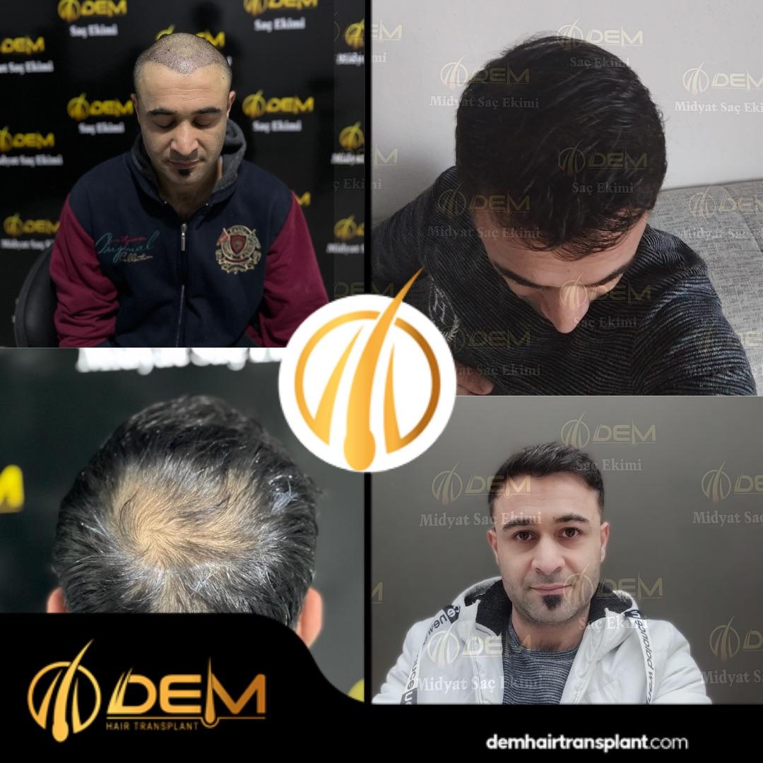 DEM sonuç 15