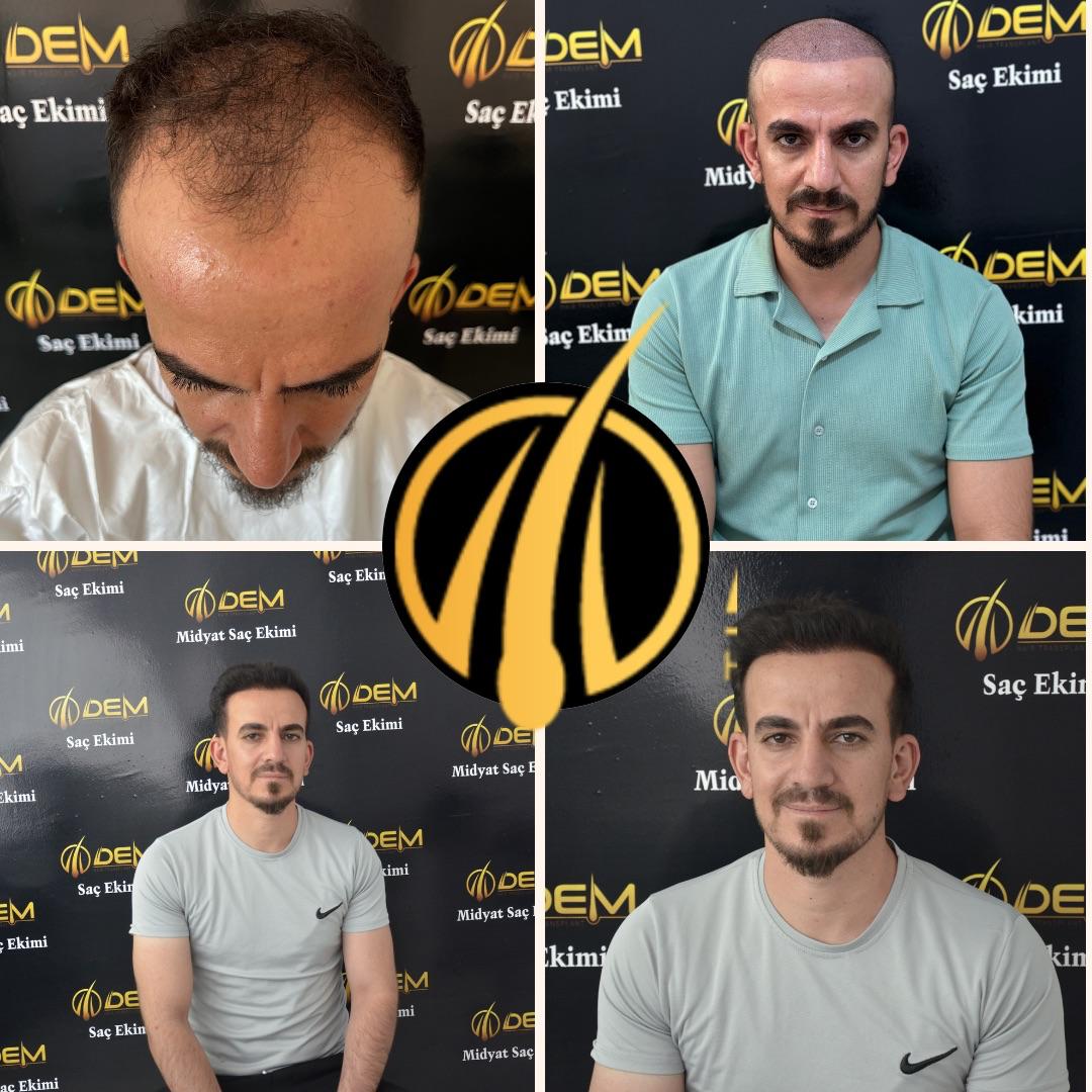 DEM sonuç 16