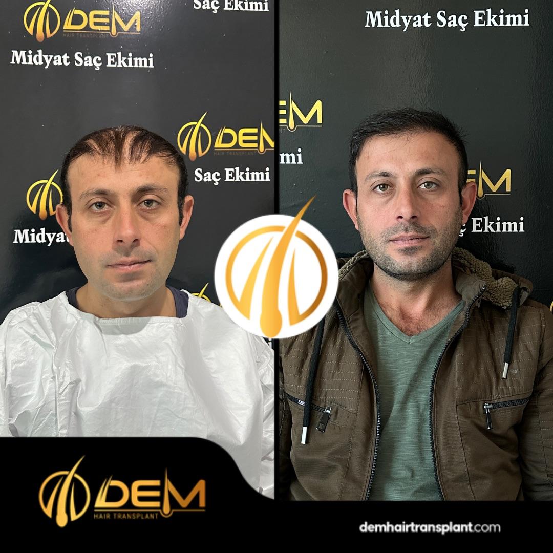 DEM sonuç 22