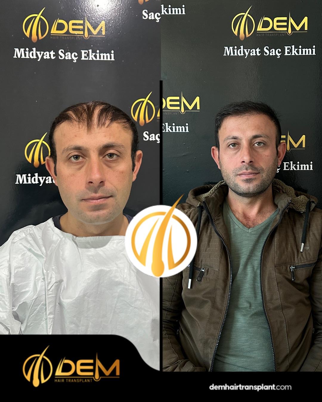 DEM sonuç 25