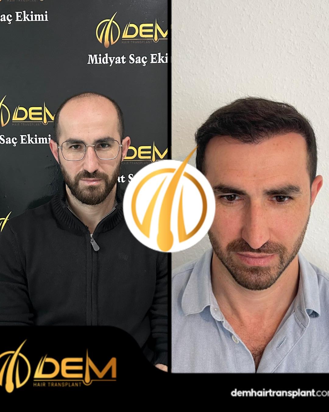 DEM sonuç 30