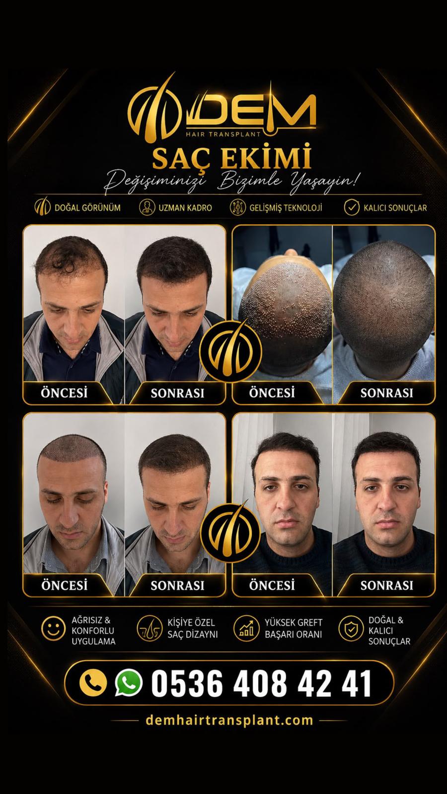 DEM sonuç 34