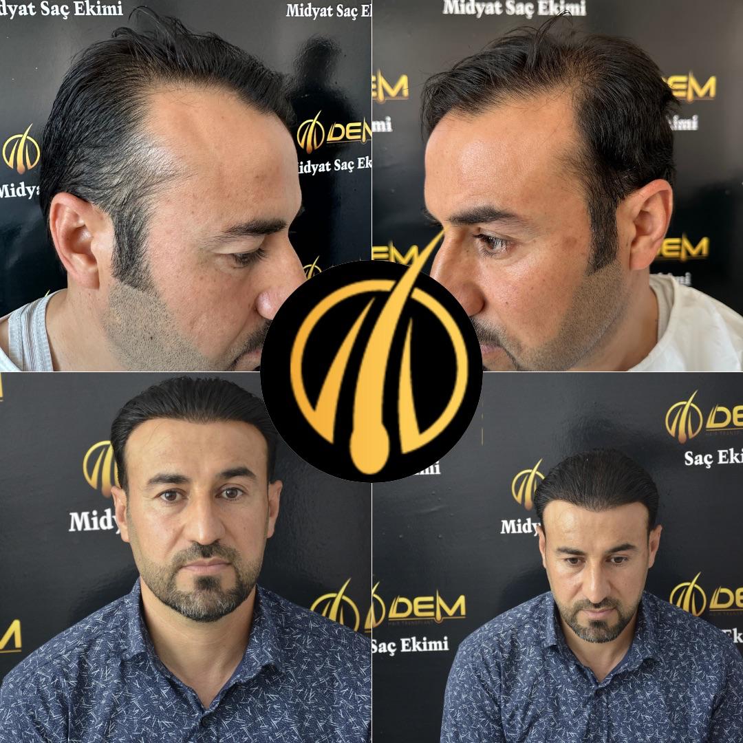 DEM sonuç 40