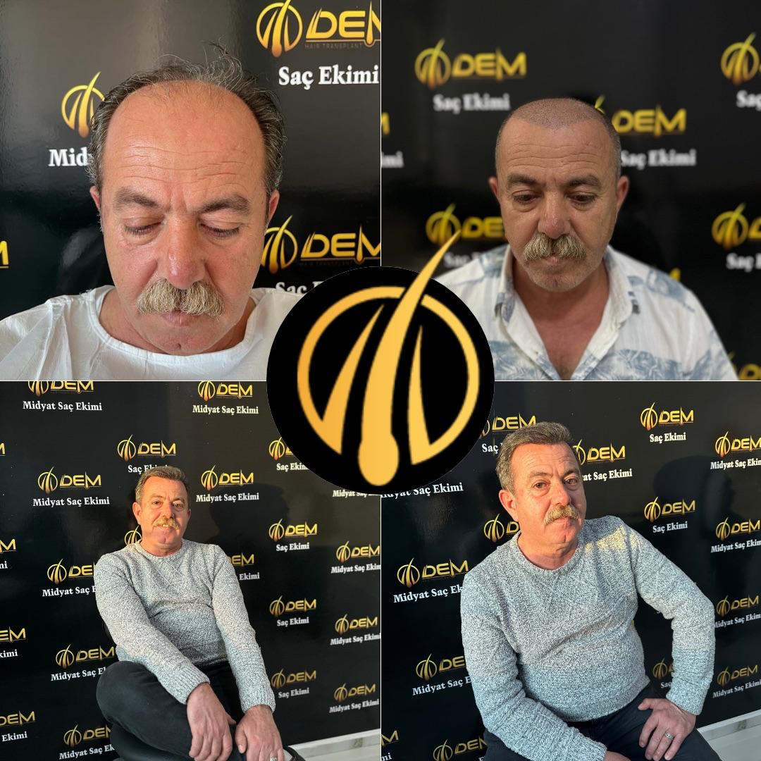 DEM sonuç 42