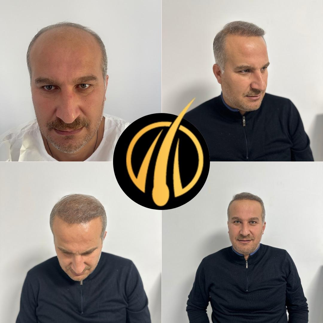 DEM sonuç 43