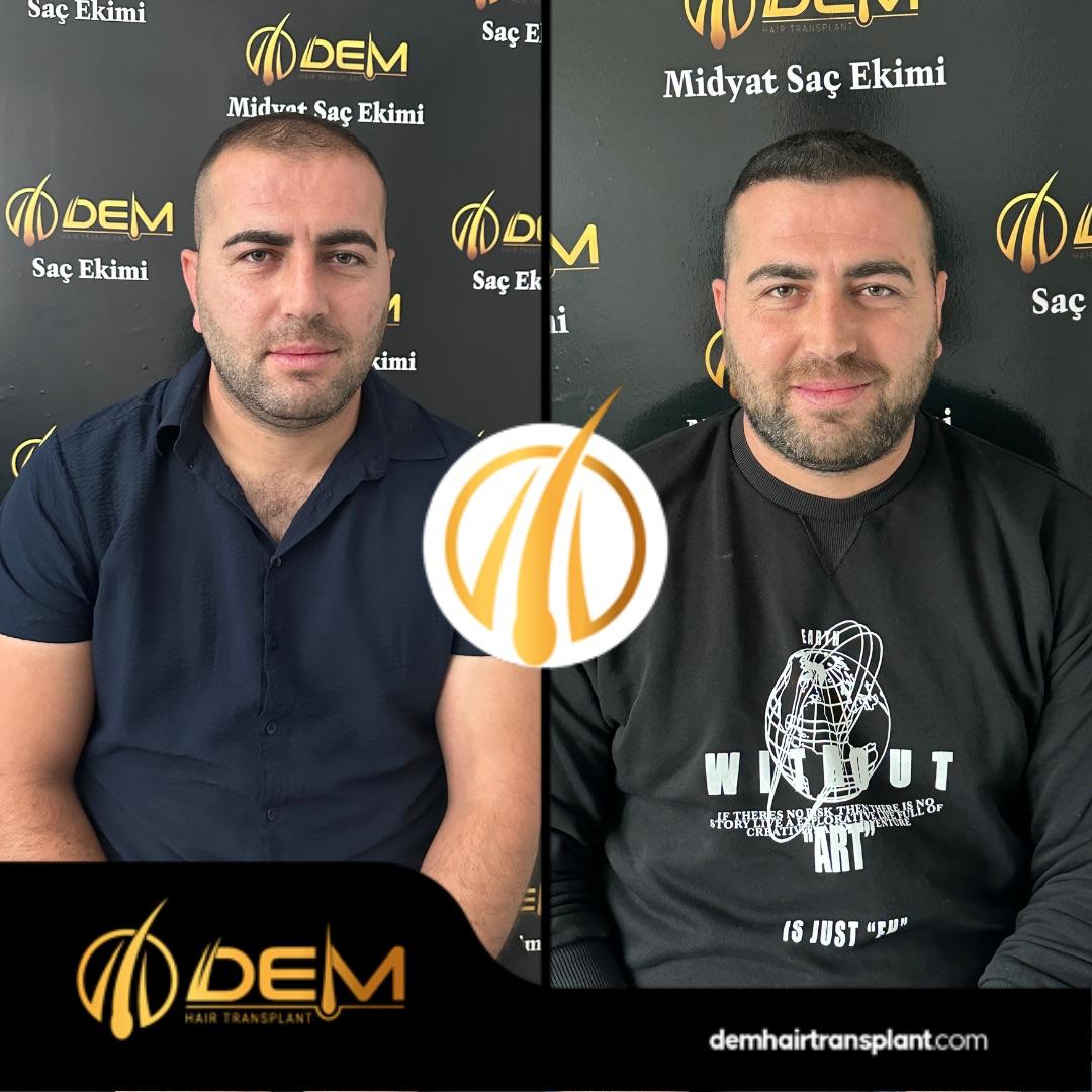 DEM sonuç 44